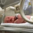Neonatal disorders