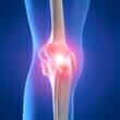 Osgood-Schlatter disease