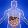 Gastrointestinal Disorders